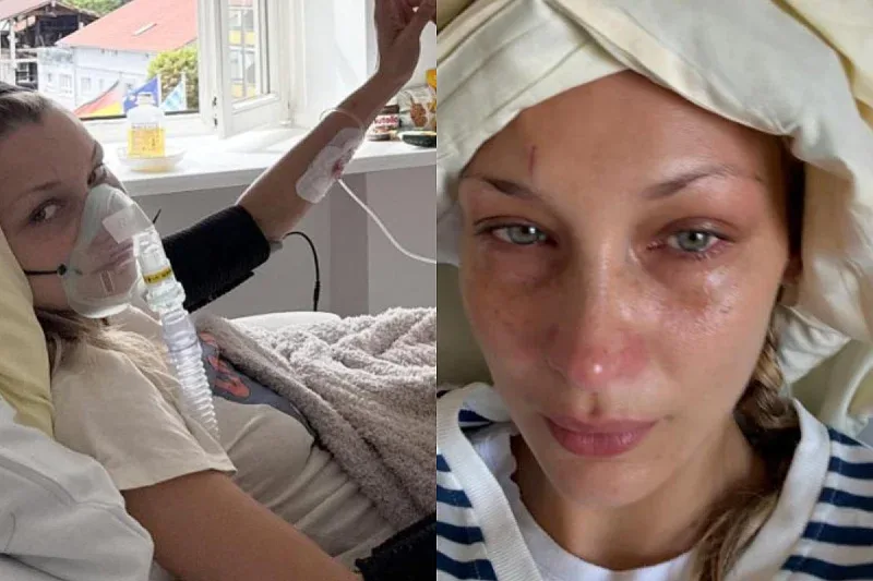 Bella Hadid izazvala zabrinutost objavom fotografija iz bolnickog kreveta
