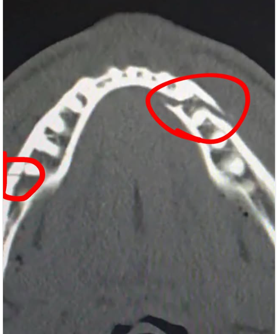 Jake Paul vilica napukla