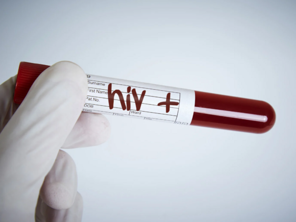 Hiv