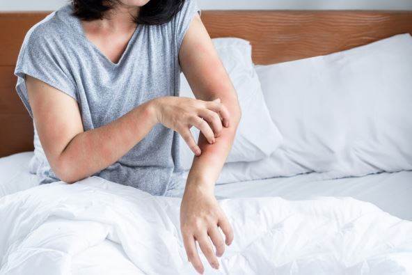 Alergija Shutterstock