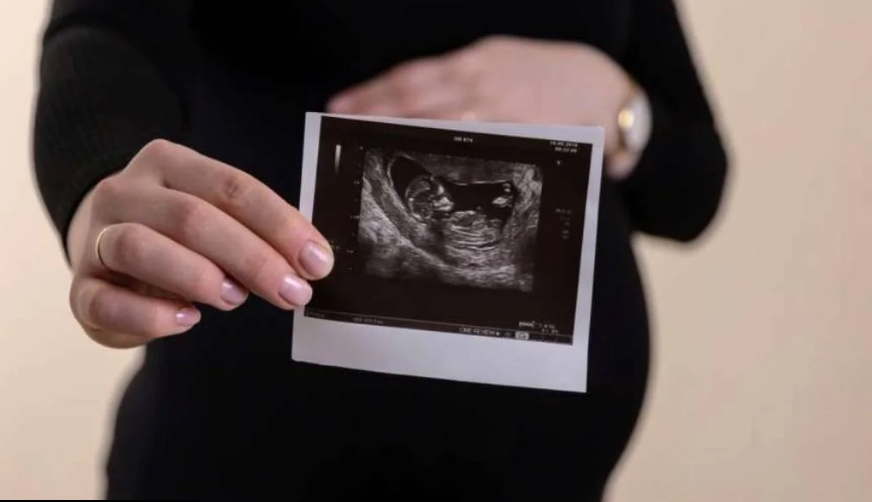 Trudnoca fetus ultrazvuk 872x502