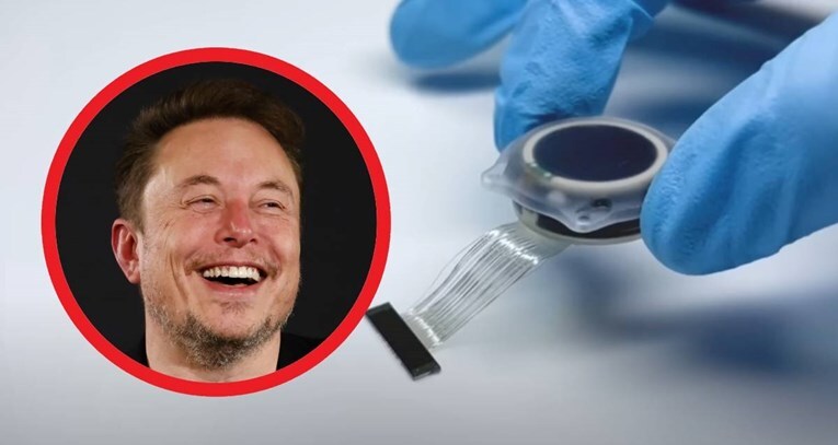 Musk Cipovi EPA