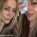 Jennifer Lopez povrijedila nos tokom probe