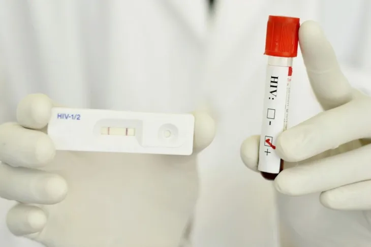 Savremeni test za brzo testiranje na HIV infekciju