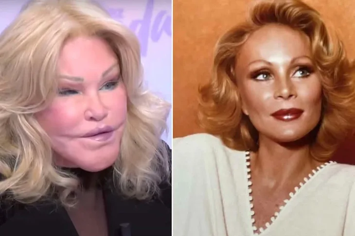Kako je Jocelyn Wildenstein izgledala u mladosti