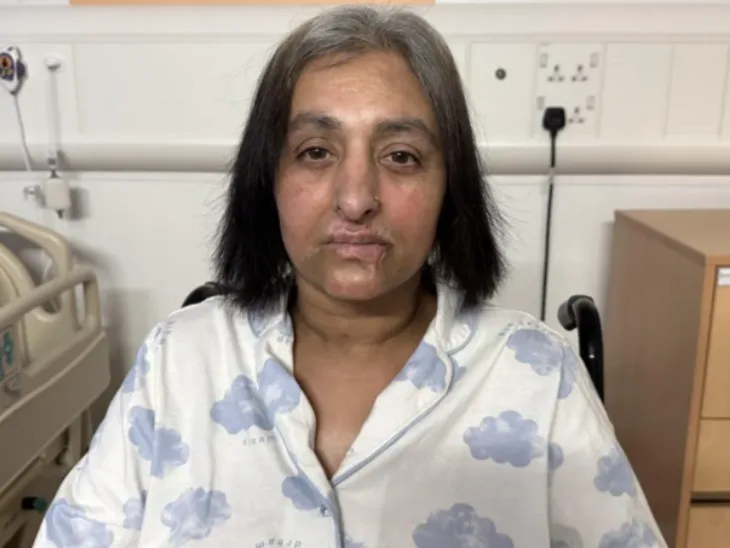 velika britanija Igrala se sa psom pa pala u komu