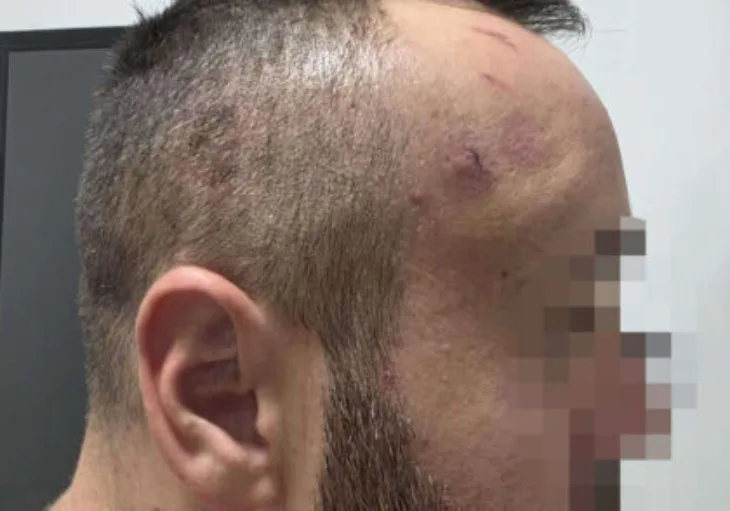 Zelimir kostic foto ustupljena fotografija 2 872x610 1 420x294