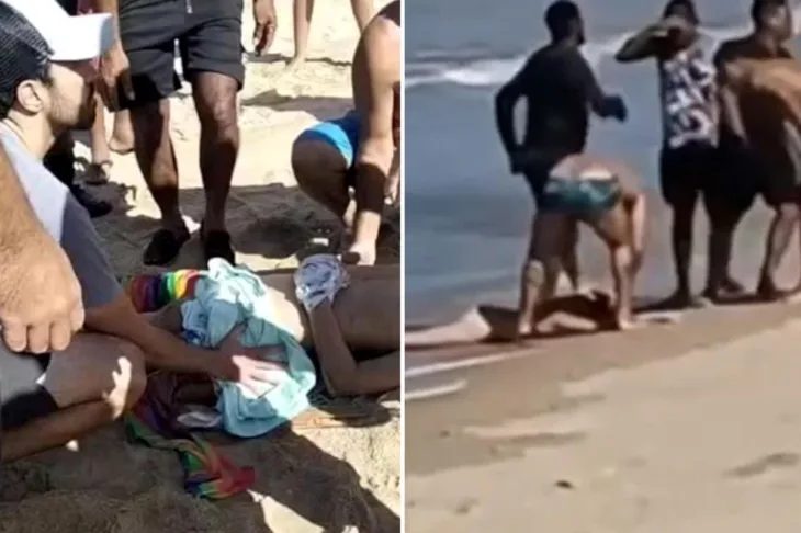 Brazil ajkula djecaku otkinula nogu