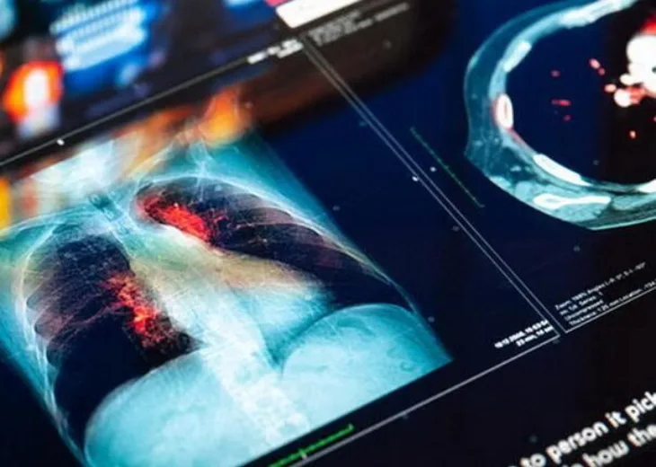 Snimak bolesnika tumor