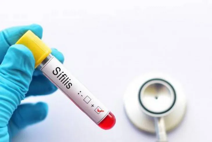 Sifilis