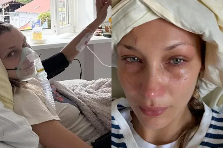 Bella Hadid izazvala zabrinutost objavom fotografija iz bolnickog kreveta