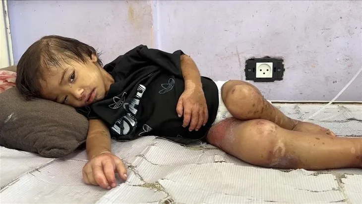 Gaza dijete