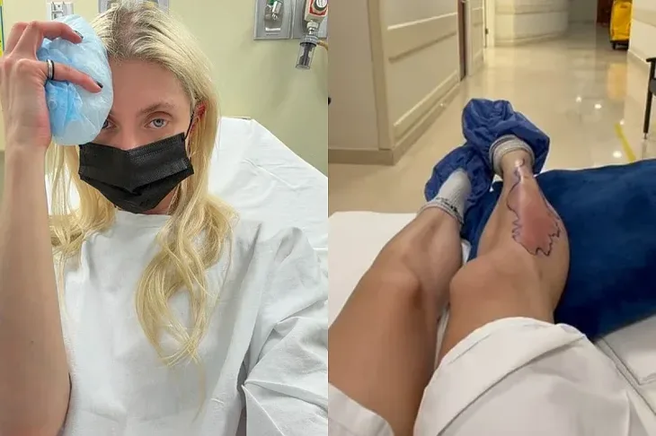 Taylor Momsen Americka pjevacica hospitalizirana nakon ugriza otrovnog pauka