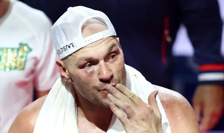 Tyson fury