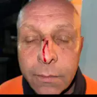 Rad radnik fb