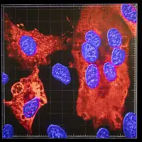 Virus x