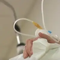 onkološki pacijenti tuzla