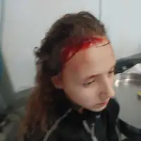 Djevojčica nakon napada