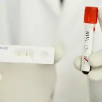 Savremeni test za brzo testiranje na HIV infekciju