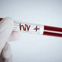 Hiv