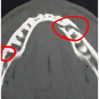 Jake Paul vilica napukla