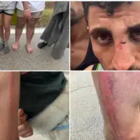 Migransti Hrvatska policija pretukla etto