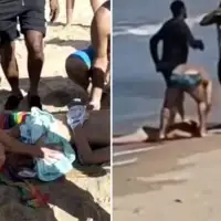 Brazil ajkula djecaku otkinula nogu
