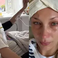 Bella Hadid izazvala zabrinutost objavom fotografija iz bolnickog kreveta