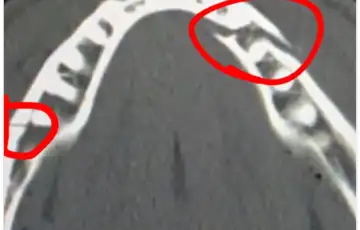 Jake Paul vilica napukla