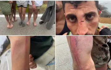 Migransti Hrvatska policija pretukla etto