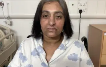 velika britanija Igrala se sa psom pa pala u komu