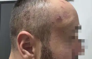 Zelimir kostic foto ustupljena fotografija 2 872x610 1 420x294