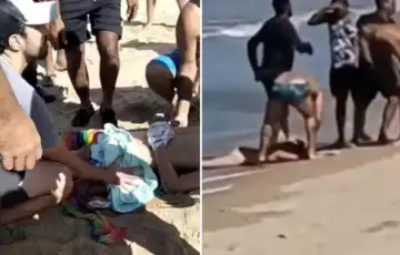 Brazil ajkula djecaku otkinula nogu