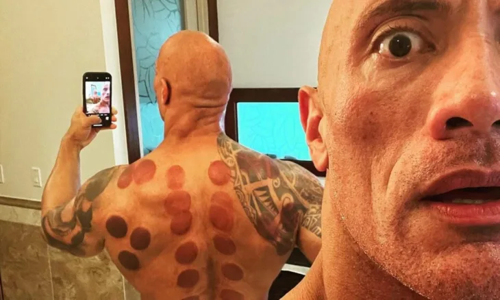 Hidzama i koliko je ucinkovita 1500x901