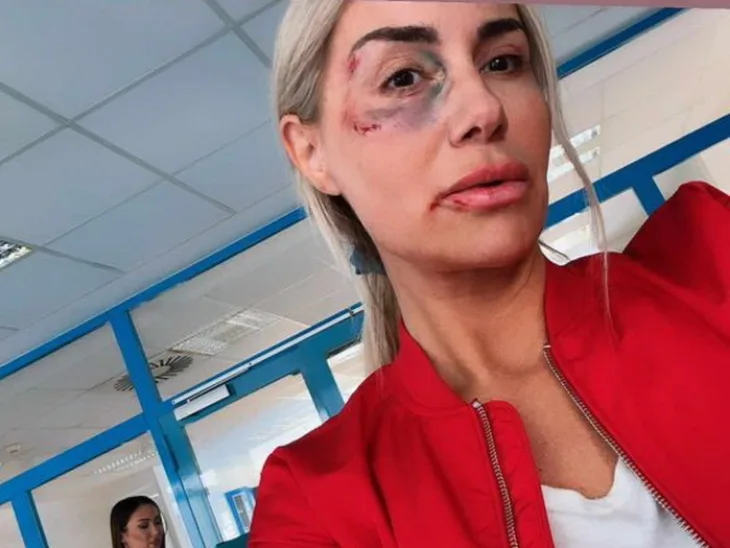 Selma bajrami u modricama zavrsila u bolnici selma bajrami 65e602fd58727