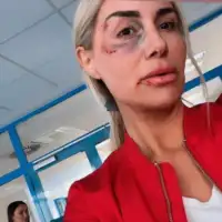 Selma bajrami u modricama zavrsila u bolnici selma bajrami 65e602fd58727