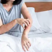 Alergija Shutterstock