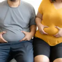 Gojaznost debeli ljudi 427x285