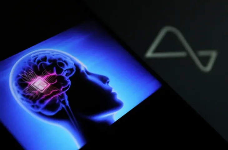 Neuralink shutterstock 2419578459 f
