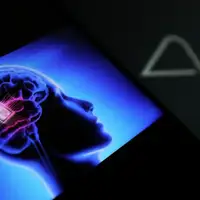 Neuralink shutterstock 2419578459 f