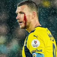Edin Dzeko nakon udarca Foto: Twitter