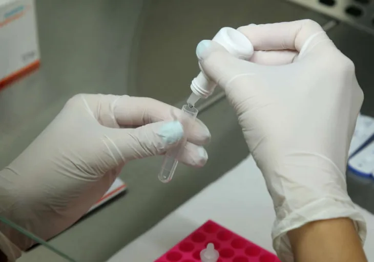 Zdravstvo rs labaratorija seroloski test korona virus kovid 07 s pasalic 872x610