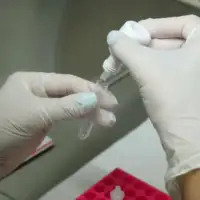 Zdravstvo rs labaratorija seroloski test korona virus kovid 07 s pasalic 872x610