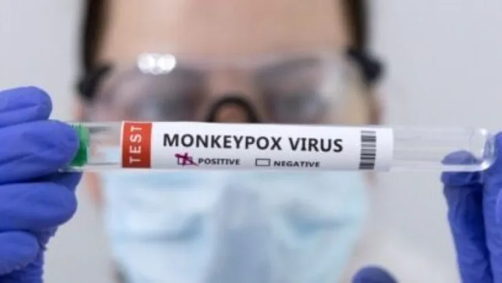majmunske boginje mpox