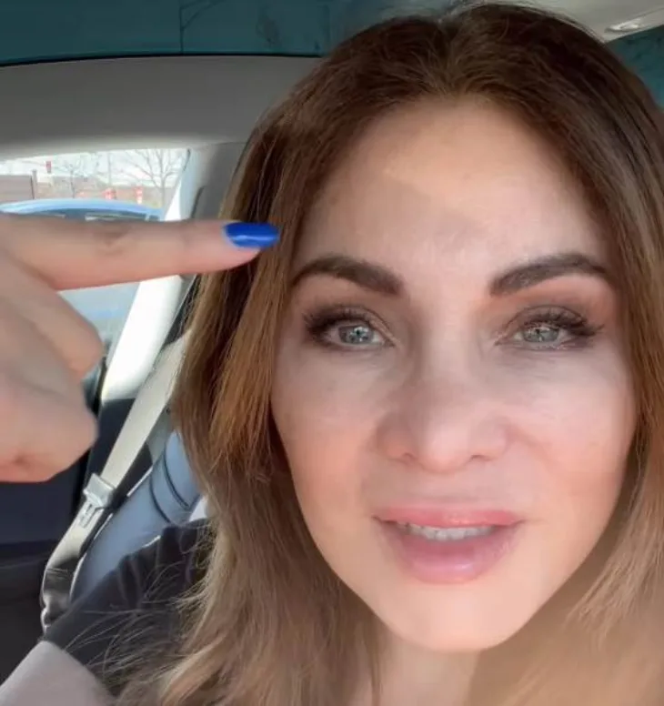 Botoks lica medicinska sestra