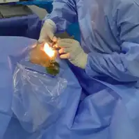 Jasmin Cerić Klinika International PLUS- zahvat na Jasminovom oku trajao je 20 minuta