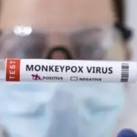 majmunske boginje mpox
