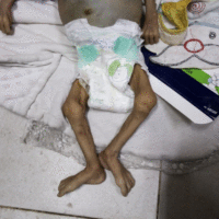 Gaza umrla beba