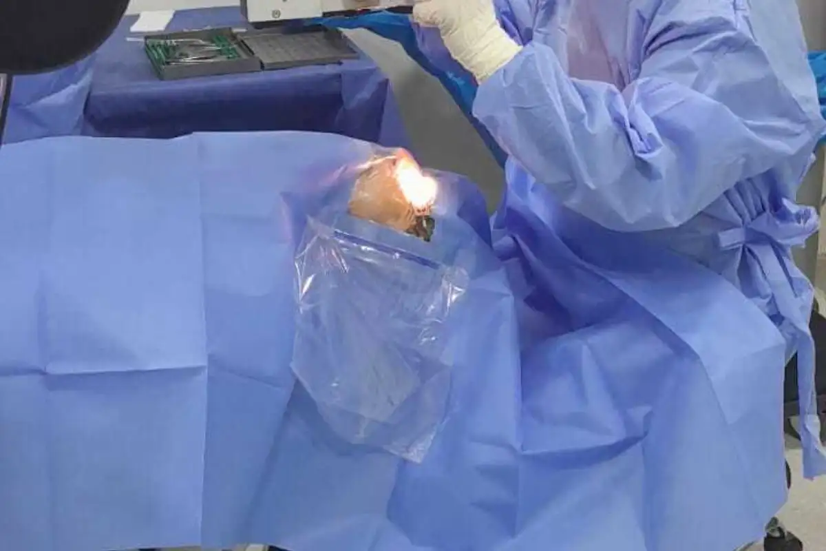 Klinika International PLUS- zahvat na Jasminovom oku trajao je 20 minuta