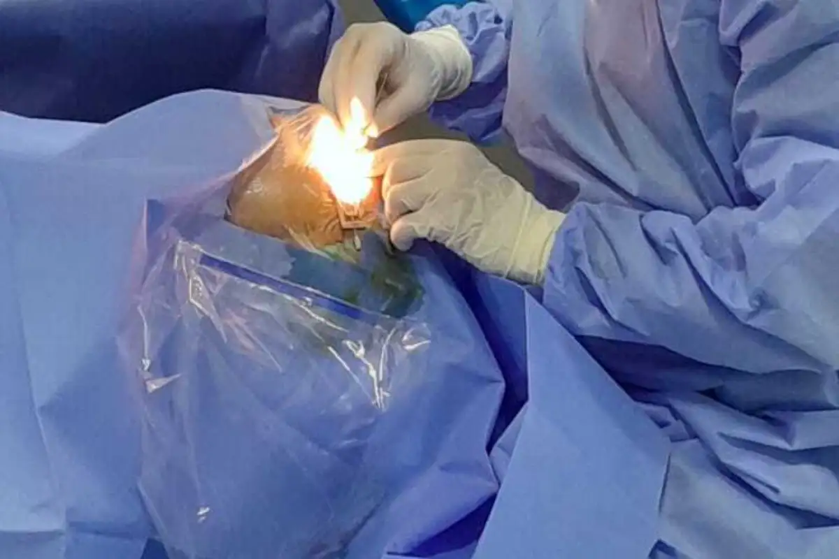 Jasmin Cerić Klinika International PLUS- zahvat na Jasminovom oku trajao je 20 minuta